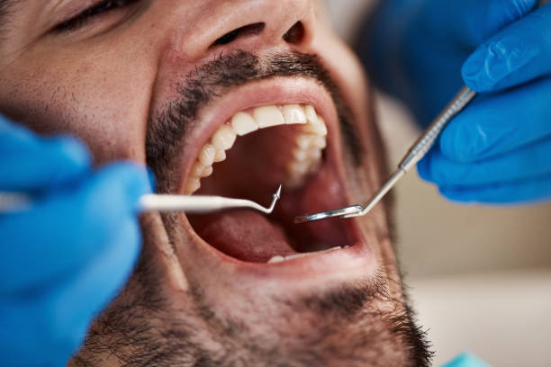 Best Urgent Care for Lost Fillings or Crowns in Fleetwood, PA